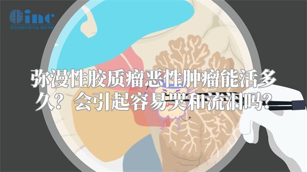 弥漫性胶质瘤恶性肿瘤能活多久？会引起容易哭和流泪吗？