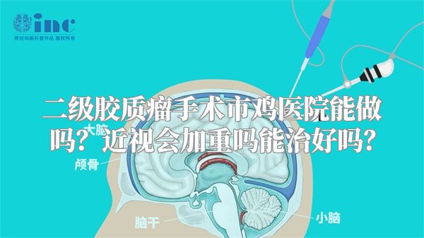 二级胶质瘤手术市鸡医院能做吗？近视会加重吗能治好吗？