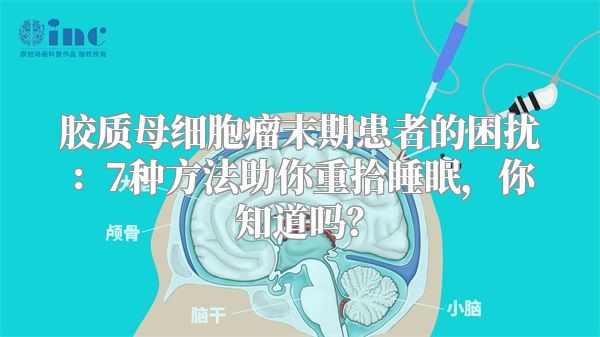 胶质母细胞瘤末期患者的困扰：7种方法助你重拾睡眠，你知道吗？