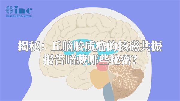 揭秘：丘脑胶质瘤的核磁共振报告暗藏哪些秘密？