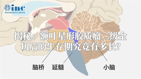 揭秘：额叶星形胶质瘤二级全切后的生存期究竟有多长？