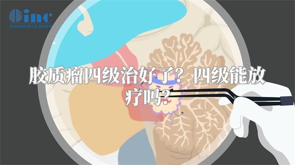 胶质瘤四级治好了？四级能放疗吗？