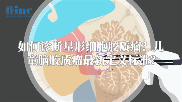 如何诊断星形细胞胶质瘤？儿童脑胶质瘤最新定义标准？