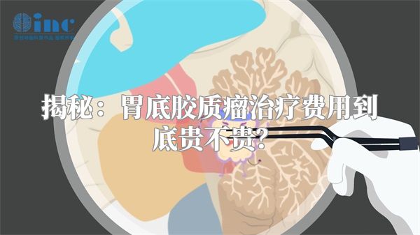 揭秘：胃底胶质瘤治疗费用到底贵不贵？