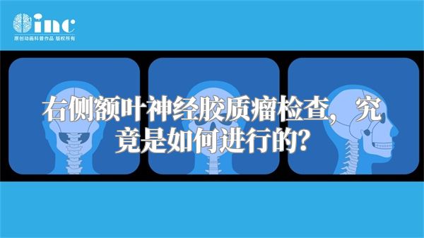 右侧额叶神经胶质瘤检查，究竟是如何进行的？