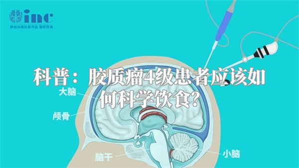 科普：胶质瘤4级患者应该如何科学饮食？