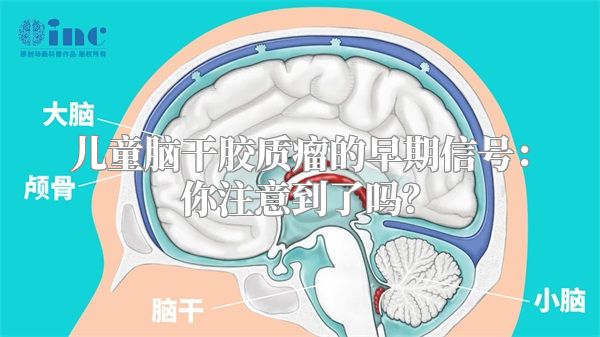 儿童脑干胶质瘤的早期信号：你注意到了吗？