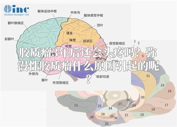 胶质瘤3年后还会头疼吗？弥漫性胶质瘤什么原因引起的呢？