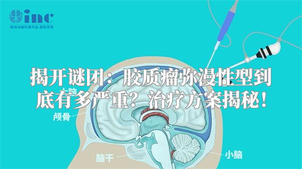 揭开谜团：胶质瘤弥漫性型到底有多严重？治疗方案揭秘！