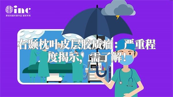 右颞枕叶皮层胶质瘤：严重程度揭示，需了解！