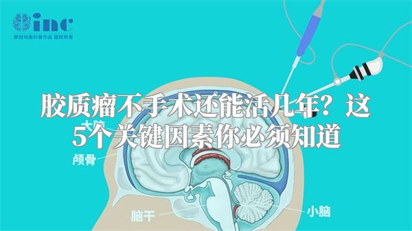 胶质瘤不手术还能活几年？这5个关键因素你必须知道