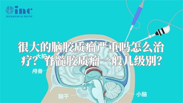 很大的脑胶质瘤严重吗怎么治疗？脊髓胶质瘤一般几级别？