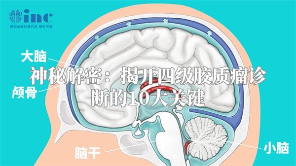 神秘解密：揭开四级胶质瘤诊断的10大关键