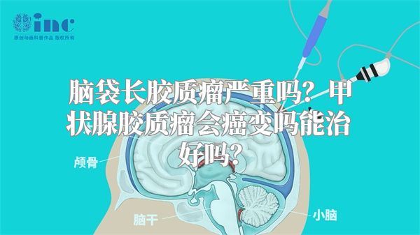 脑袋长胶质瘤严重吗？甲状腺胶质瘤会癌变吗能治好吗？