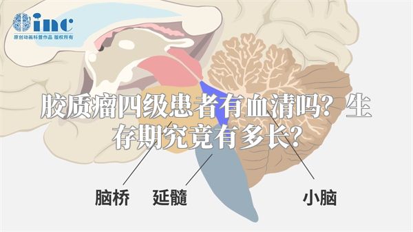 胶质瘤四级患者有血清吗？生存期究竟有多长？