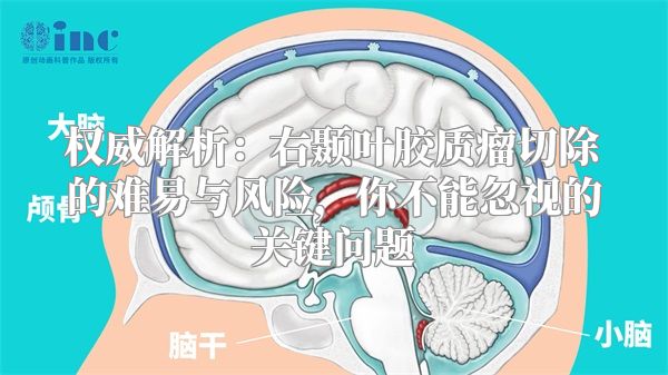 权威解析：右颞叶胶质瘤切除的难易与风险，你不能忽视的关键问题