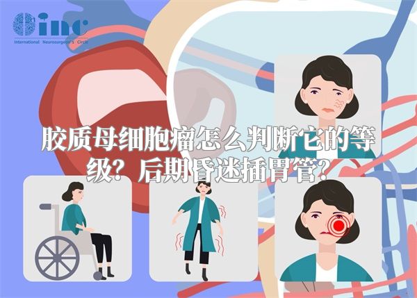 胶质母细胞瘤怎么判断它的等级？后期昏迷插胃管？