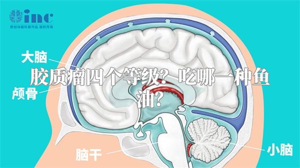 胶质瘤四个等级？吃哪一种鱼油？