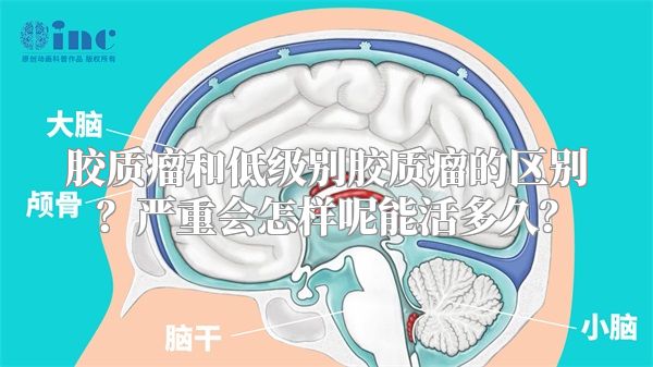 胶质瘤和低级别胶质瘤的区别？严重会怎样呢能活多久？