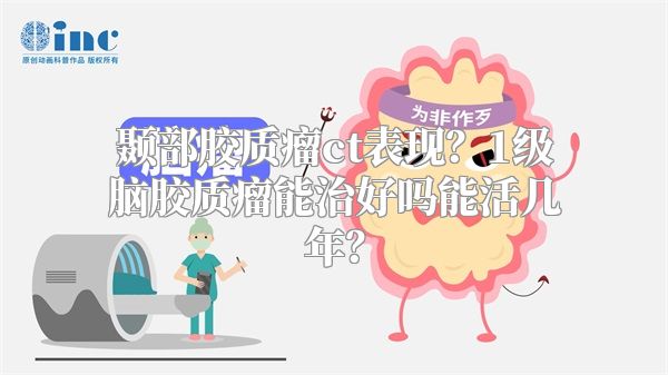 颞部胶质瘤ct表现？1级脑胶质瘤能治好吗能活几年？