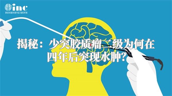 揭秘：少突胶质瘤二级为何在四年后突现水肿？