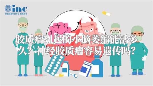 胶质瘤引起的小脑萎缩能活多久？神经胶质瘤容易遗传吗？