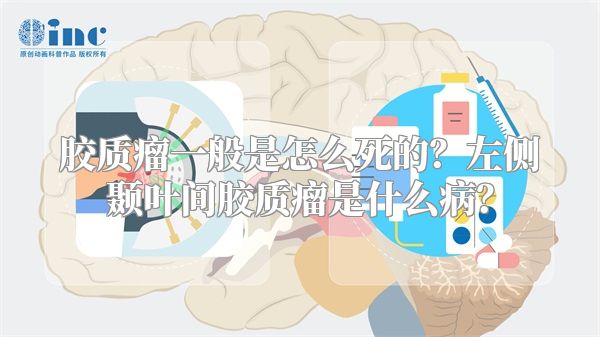 胶质瘤一般是怎么死的？左侧颞叶间胶质瘤是什么病？