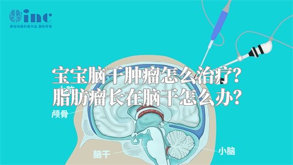 宝宝脑干肿瘤怎么治疗？脂肪瘤长在脑干怎么办？