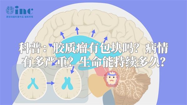 科普：胶质瘤有包块吗？病情有多严重？生命能持续多久？