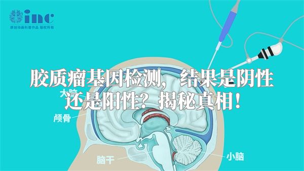 胶质瘤基因检测，结果是阴性还是阳性？揭秘真相！