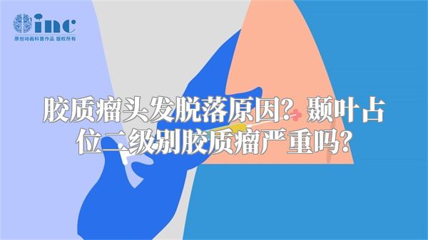 胶质瘤头发脱落原因？颞叶占位二级别胶质瘤严重吗？