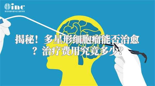 揭秘！多星形细胞瘤能否治愈？治疗费用究竟多少？