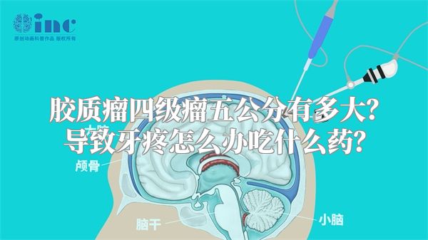 胶质瘤四级瘤五公分有多大？导致牙疼怎么办吃什么药？