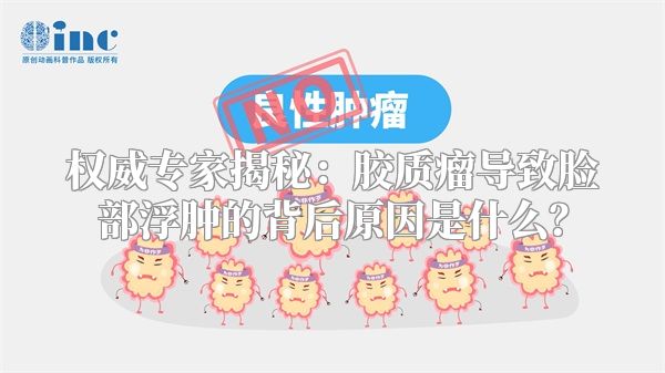 权威专家揭秘：胶质瘤导致脸部浮肿的背后原因是什么？