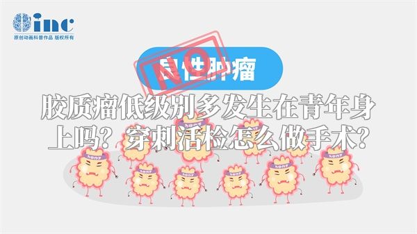 胶质瘤低级别多发生在青年身上吗?穿刺活检怎么做手术?