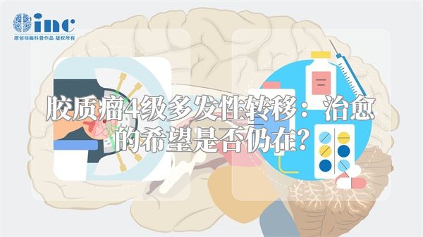 胶质瘤4级多发性转移:治愈的希望是否仍在?