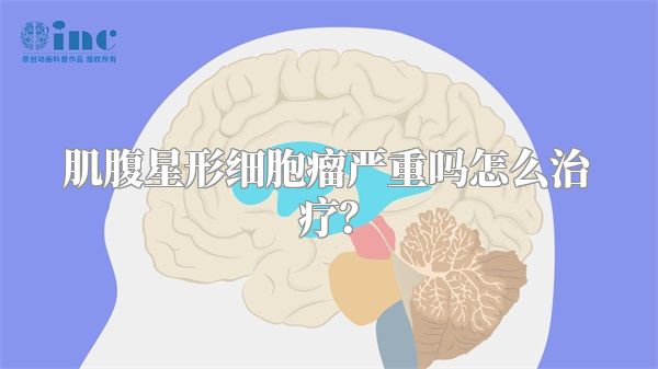 肌腹星形细胞瘤严重吗怎么治疗?