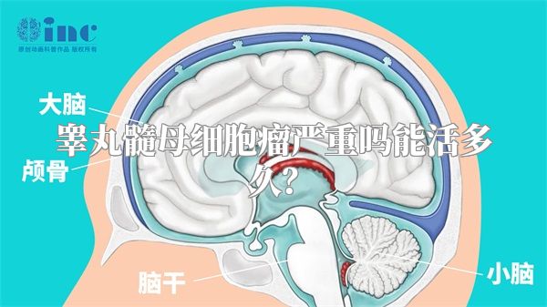 睾丸髓母细胞瘤严重吗能活多久?